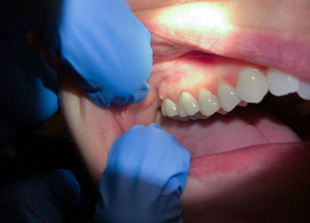 Best Pediatric Emergency Dentist in Murphy, MO