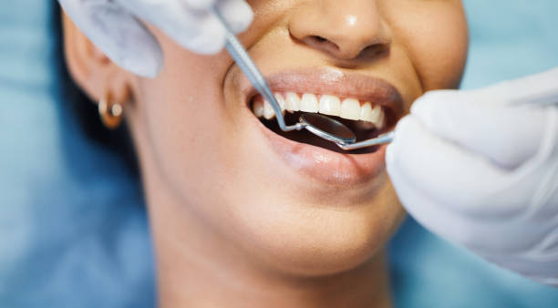 Best Emergency Dental Care for Broken or Chipped Teeth in Murphy, MO