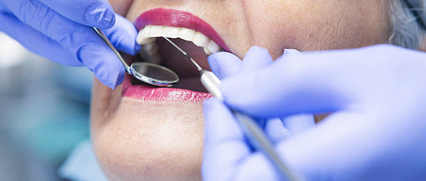Best Emergency Gum Treatment in Murphy, MO